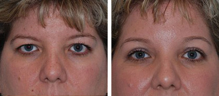 View before & after results from Cross Medical Group in Philadelphia, PA View before & after results from Cross Medical Group in Philadelphia, PA