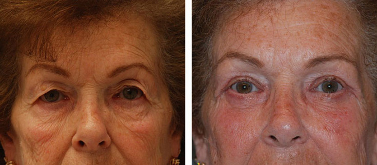 View before & after results from Cross Medical Group in Philadelphia, PA View before & after results from Cross Medical Group in Philadelphia, PA